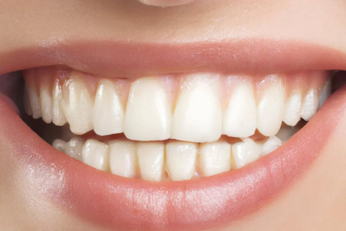 Smile Perfection and Lifestyle: How to Straighten Your Teeth Without Disrupting Your Routine