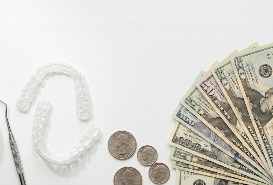 Clear aligners beside British pound notes and coins representing affordable clear aligner treatment.