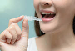 Clear Aligners for Gaps Between Teeth: What Treatment Typically Covers
