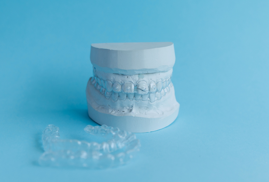 Clear aligners on a dental model representing insurance and FSA coverage for clear aligner treatment.