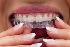 How Clear Aligners Work: The Simple Science Behind Teeth Movement