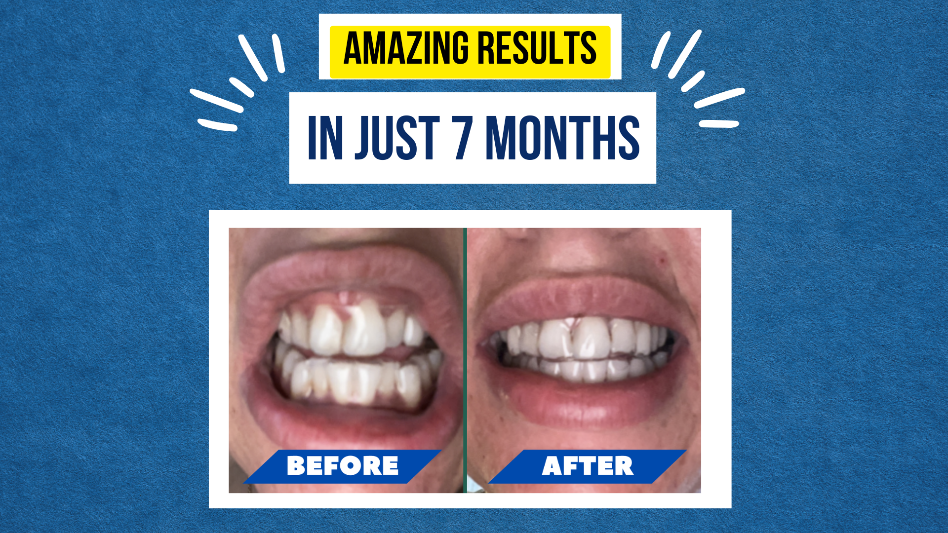 Megan’s Smile Journey – From First Step to Final Smile