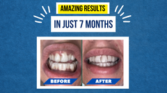 Megan’s Smile Journey – From First Step to Final Smile