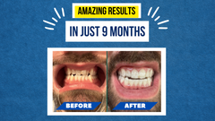Michael’s Smile Journey – Dedication, Guidance, and a Smile to Be Proud Of