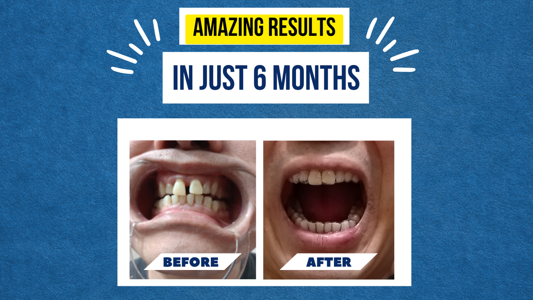Sung Kim’s Smile Story – A 6-Month Transformation Worth Smiling About