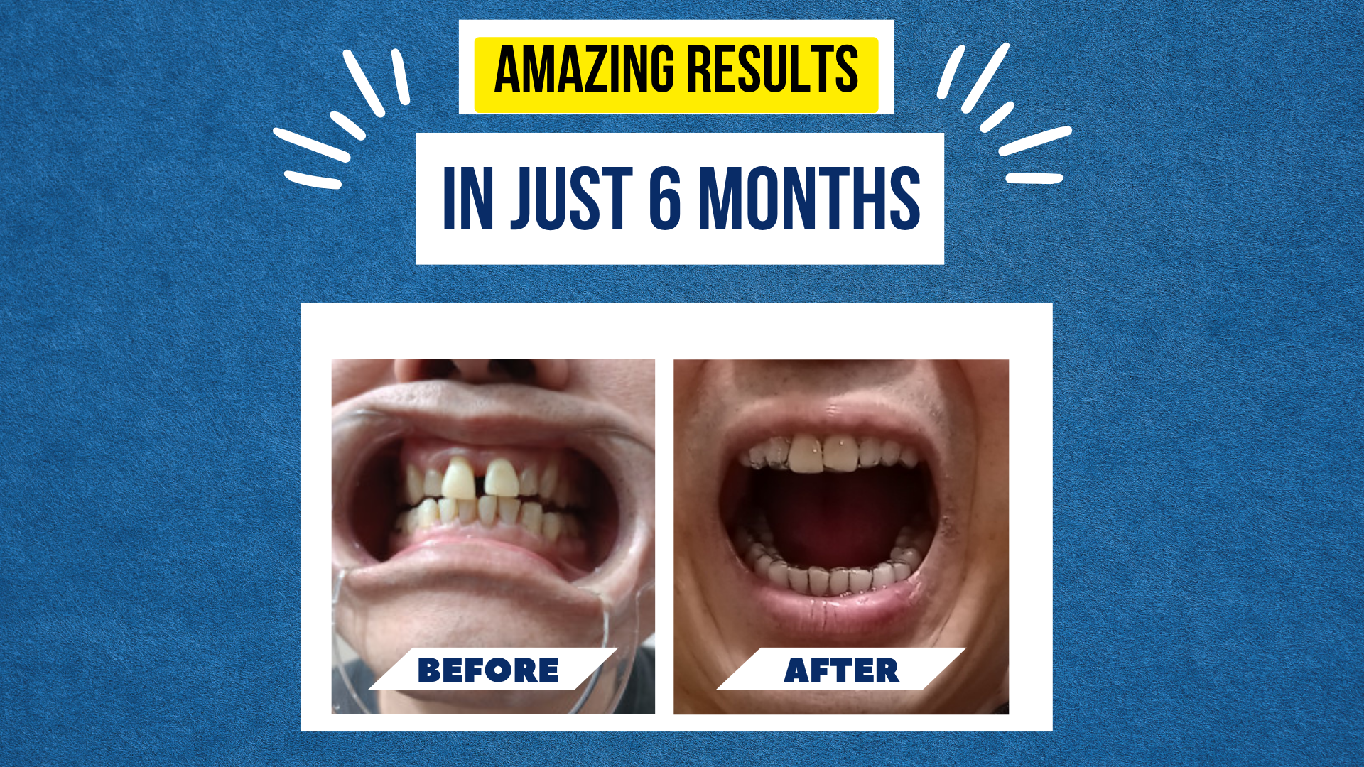 Sung Kim’s Smile Story – A 6-Month Transformation Worth Smiling About