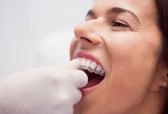 How to Clean Clear Aligners Safely at Home: Dentist-Approved Maintenance Tips