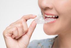 Transparent Braces vs. Clear Aligners: Which Saves You More in 2025?