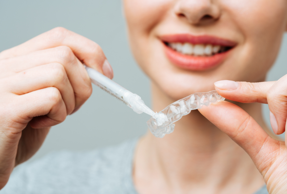Woman smiling while applying whitening gel to clear aligner tray, demonstrating proper aligner hygiene and cleaning routine.