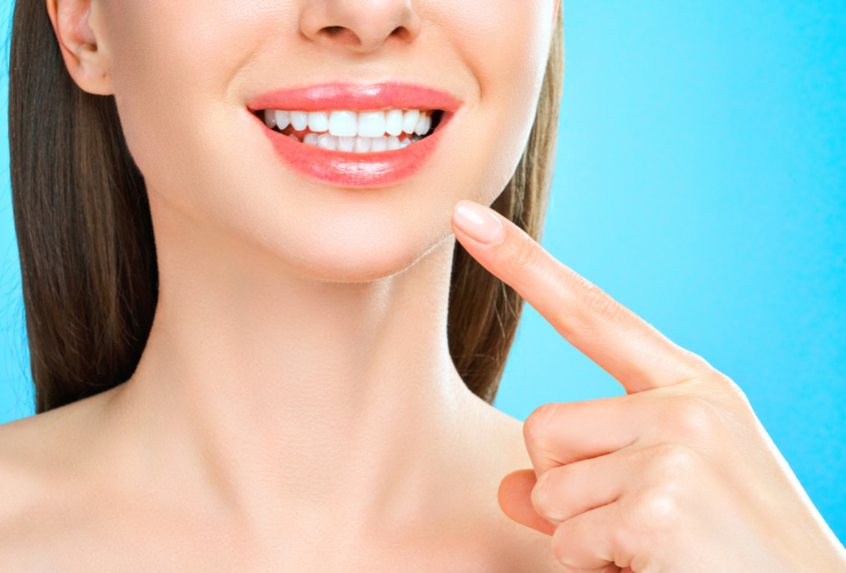 Healthy white smile with finger pointing to teeth, teeth whitening with clear aligners.