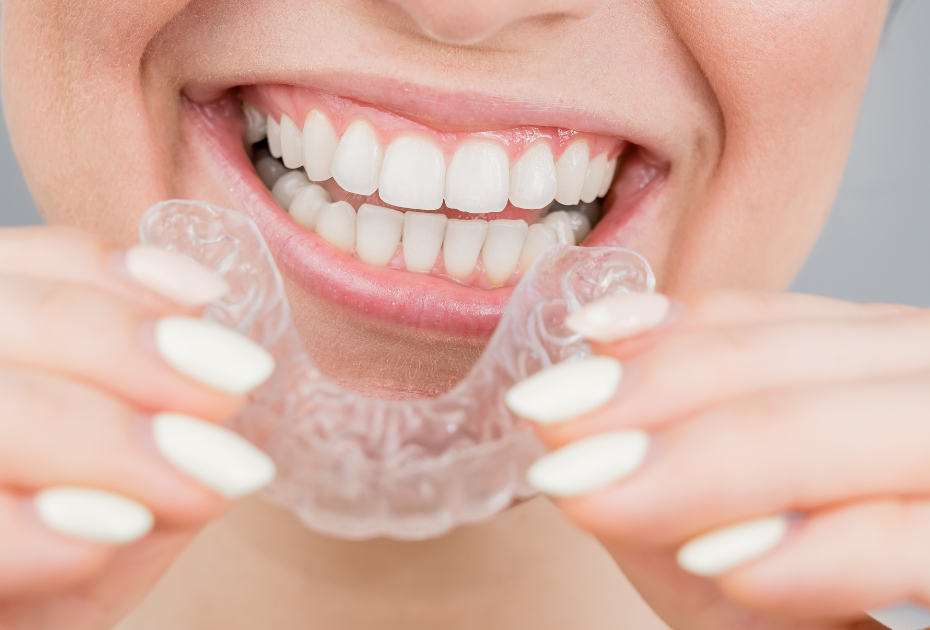 Smiling person holding clear aligners before wearing them