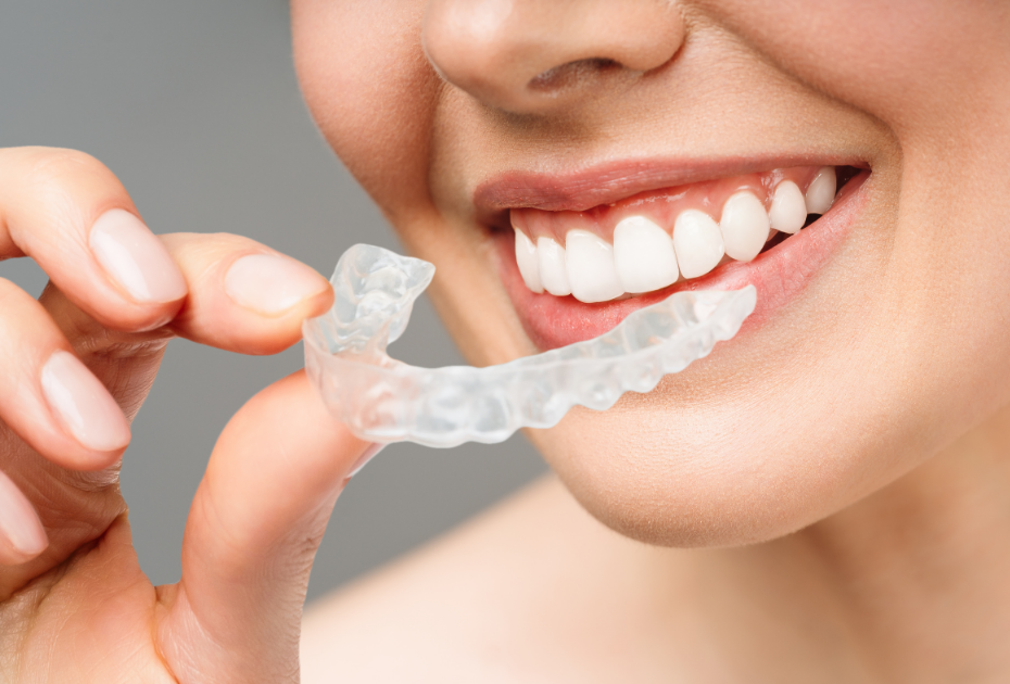 Person holding clear aligners near a smiling mouth, showing invisible braces used for teeth straightening.