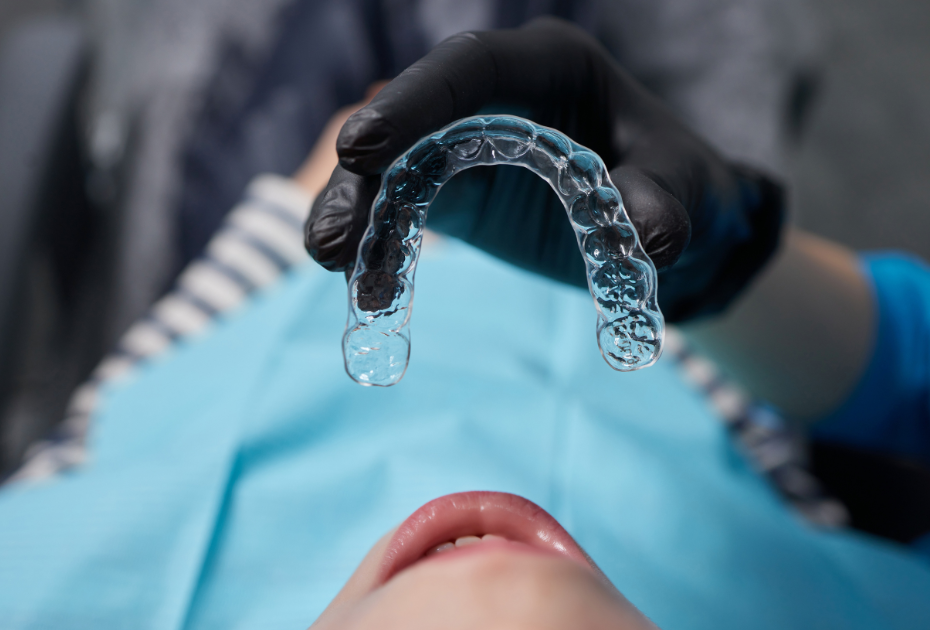 Clear dental aligner tray being held above a patient’s mouth during a clear aligner treatment fitting.