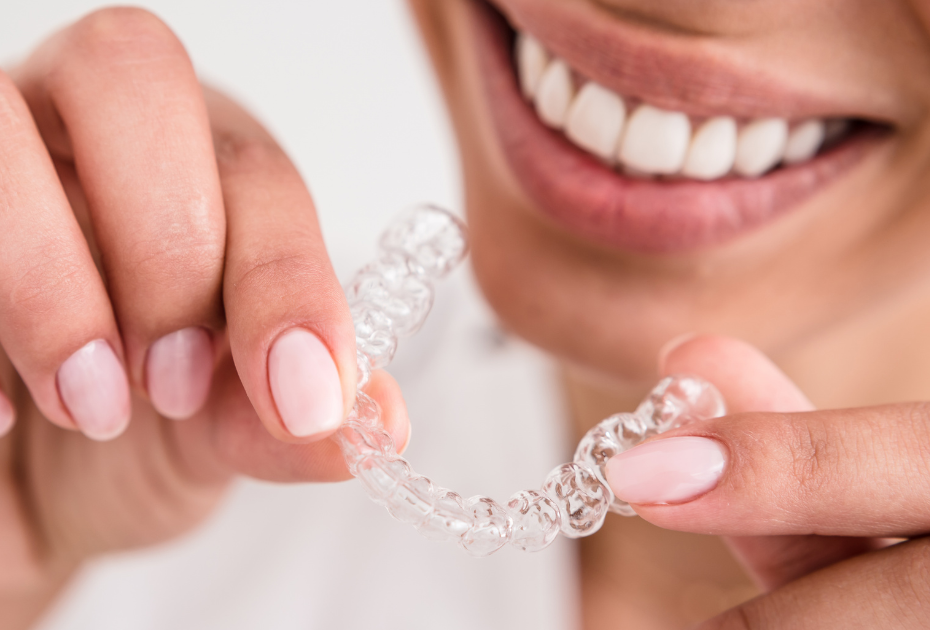 Consultation with Smileie Expert