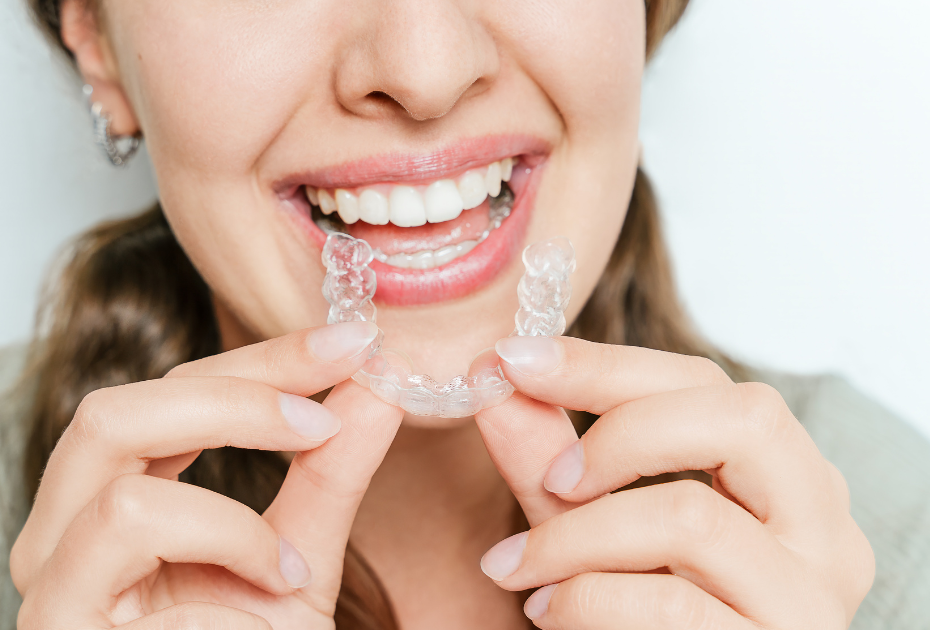 Clear aligners (invisible braces) being held and placed on teeth by a smiling woman in a close-up dental treatment concept