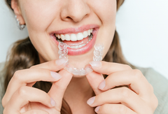 Why Clear Aligners Are Becoming the First Choice for Teeth Straightening in the USA (2026 Trends)