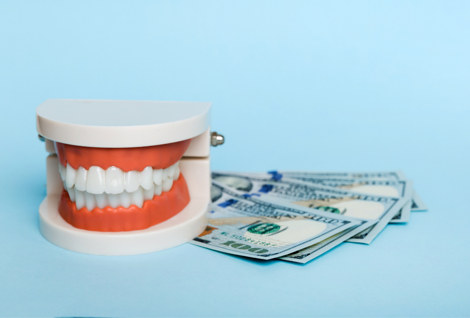 Clear aligners cost factors in USA concept with dental model and cash.