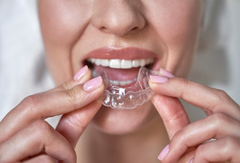 Clear Aligners Step-by-Step: What Happens From Free Assessment to Final Retainer