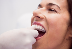 Best Invisible Braces for Adults in 2025: Comfortable, Affordable, and Effective Choices