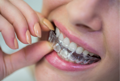 Why Do My Aligners Feel Tight on the First Day? Normal vs Not-Normal Discomfort