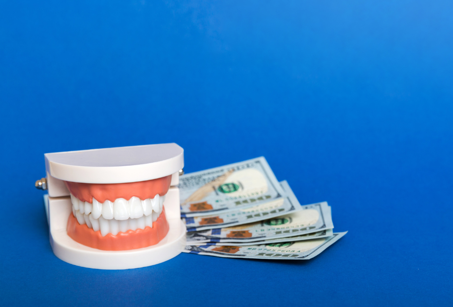 Clear aligner dental model with payment options for choosing a clear aligner plan