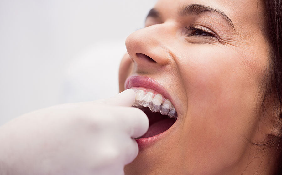 Advantage of invisible braces