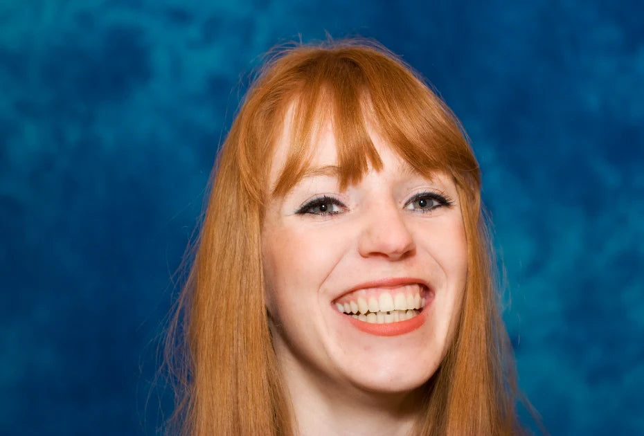 Dental overbite example before treatment