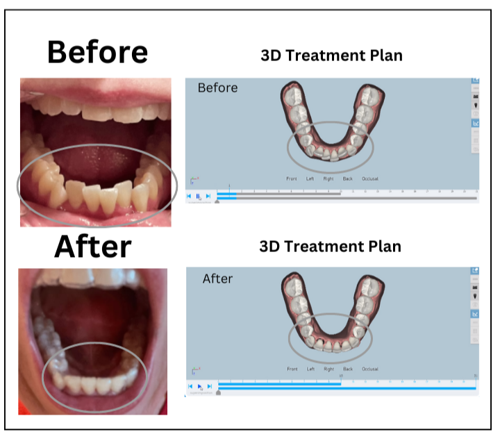 Day-Time Dual Arch