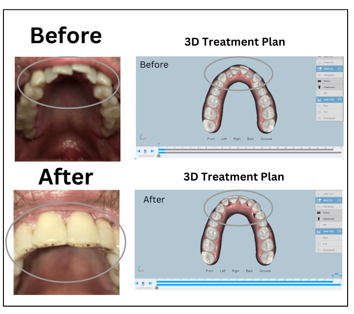 Day-Time Dual Arch