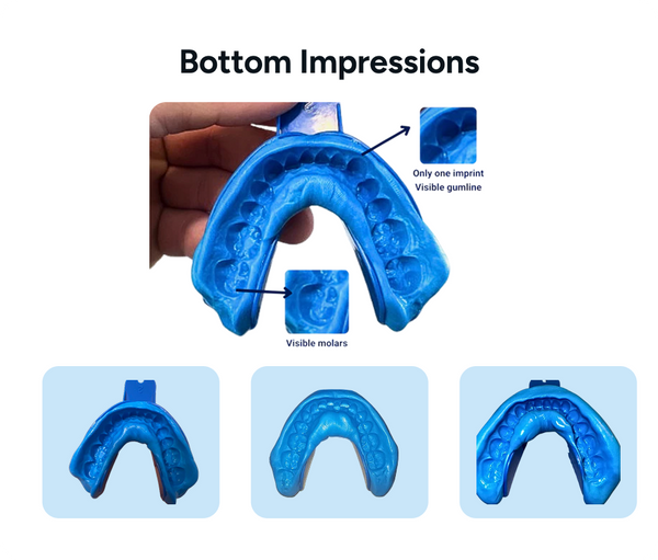 Impression guide – Smileie