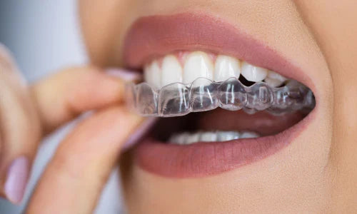 Smileie PRO Single Arch